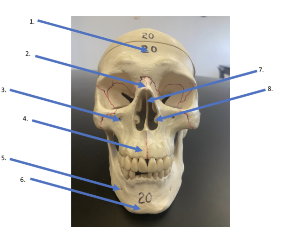 <p>what is the name of #6</p>