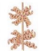 <p>What streptomyces spore-bearing structure is this?</p>