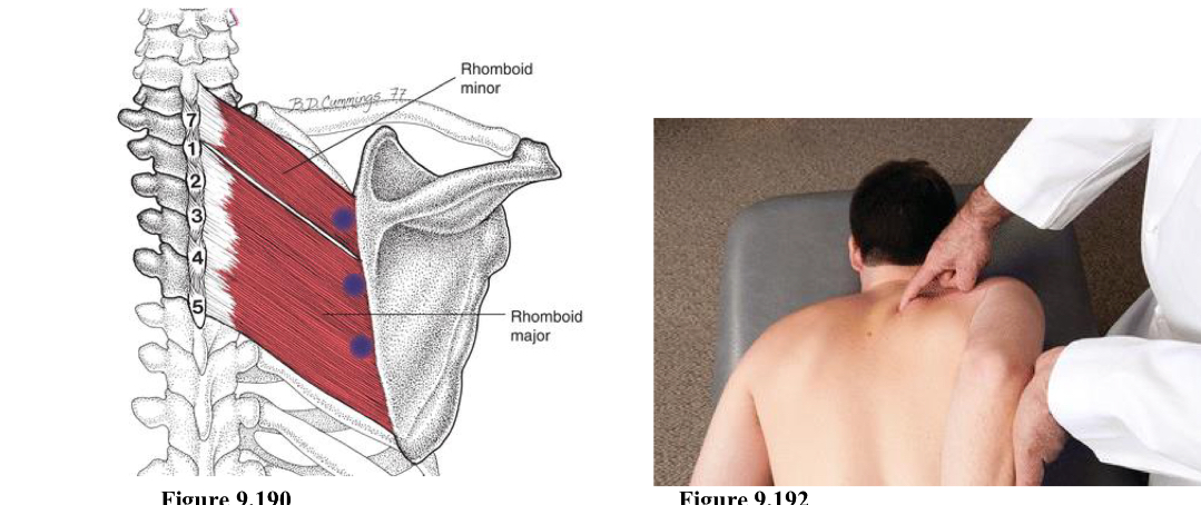<p>E Add</p><p>Location is along the medial border of the scapula at the attachment of the rhomboid muscles</p><ol><li><p>Pt prone</p></li><li><p>Physician stands on either side (Cornick stood on opposite side)</p></li><li><p>Point is along medial border of scapula. Press medial to lateral. Shoulder be between spine of scapula and angle of scapula.</p></li><li><p>One hand on point, other hand holds elbow to set into position.</p></li><li><p>Shoulder is extended and adducted by pulling arm/elbow posterior and medial</p></li><li><p>Try to have pt hand stay on side and not on their back.</p></li></ol><p></p>