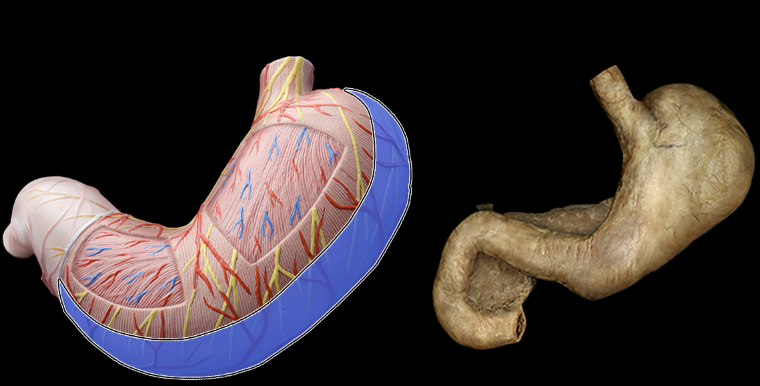term image