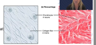 <p>Strongest/most durable cartilage </p><p>Found in intervertebral discs, serves as shock absorbing material between bones in the knee</p>