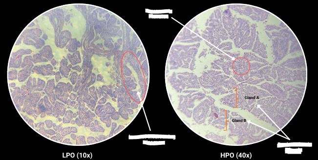 <p>What are the arrows pointing?</p>
