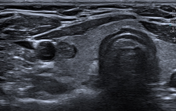 <p>What is the pathology </p>