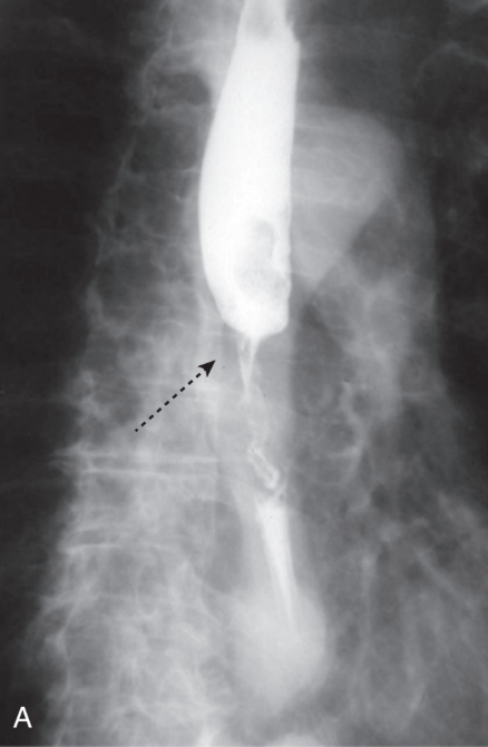 <p>diagnosis</p>