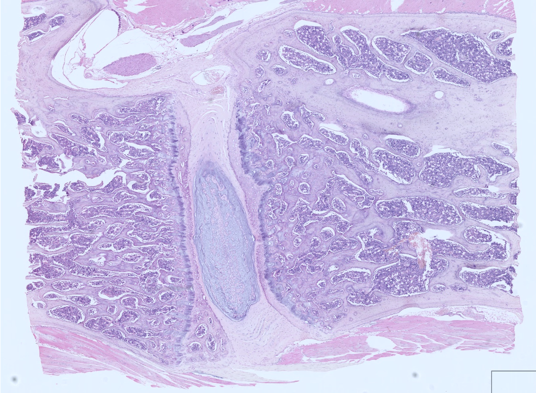 <p>fibrocartilage- meniscus, IVD, pubic symphisis. </p><p><span style="font-family: "Gill Sans MT";"><strong>No perichondrium cover! </strong></span><strong>This is different from the other two types of cartilage.</strong></p><p><span style="font-family: "Gill Sans MT";"><strong>TypeI Collagen </strong>fibers/bundlespredominate</span></p>