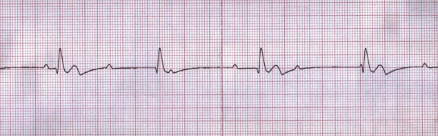 <p>Which cardiac arrest rhythm is shown here?</p>