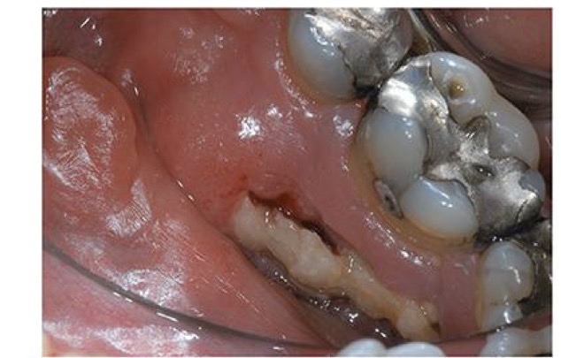 <p>CHẨN ĐOÁN?</p>