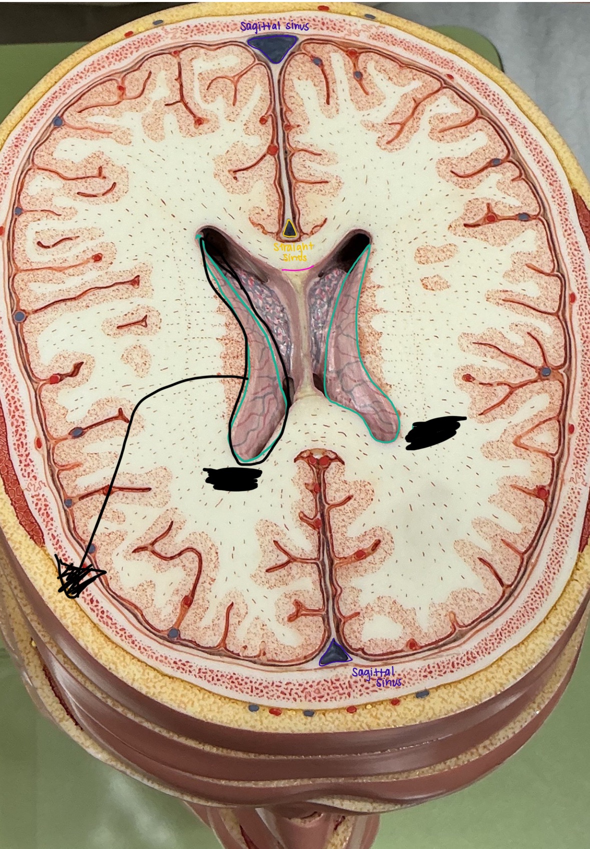 term image