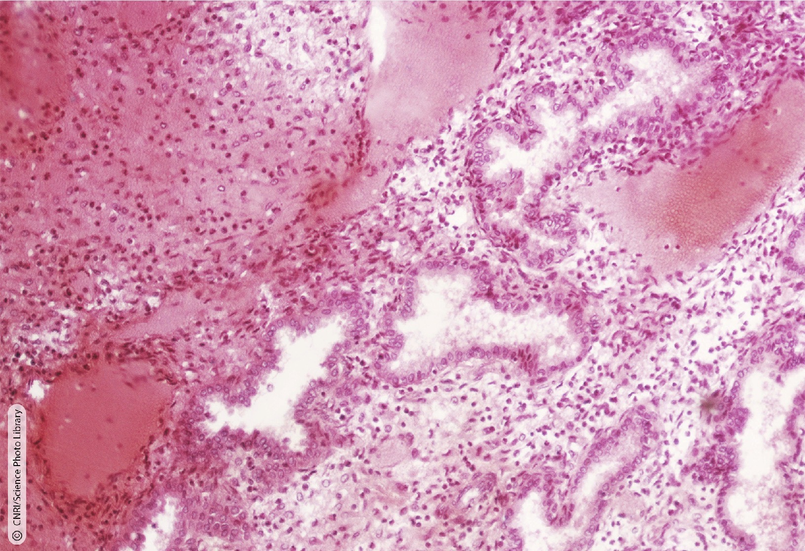 <p>Identify the Histology</p>