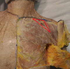 <p>Identify the structure</p>