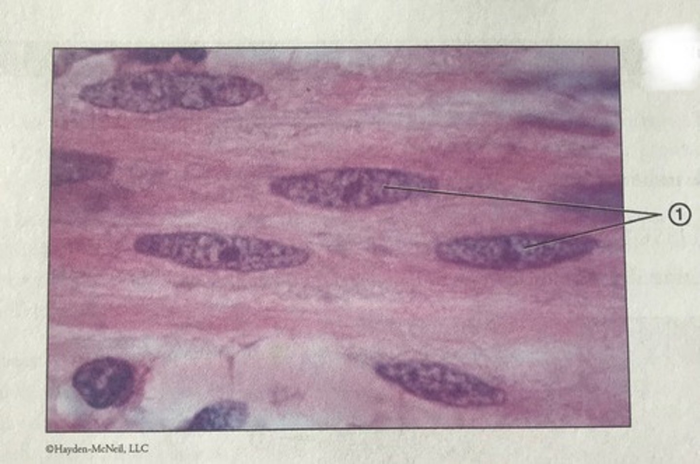 <p>Which type of muscle tissue is this? What is #1?</p>