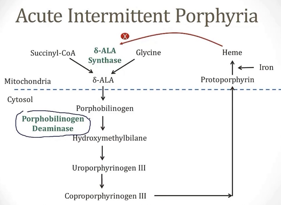 <p>-a porphyria condition</p><p>-PBGD</p><p>-autosomal dominant</p><p>-acute, intermittent; porphyrobinogen; delta-ALA synthase</p><p>-pain(abdominal), port wine colored urine, polyneuropathy, psychological disturbances, and precipitation by drugs</p><p>-meds that induce the CYP450 enzyme</p><p>-inhibition of heme production through glucose or hemin</p>