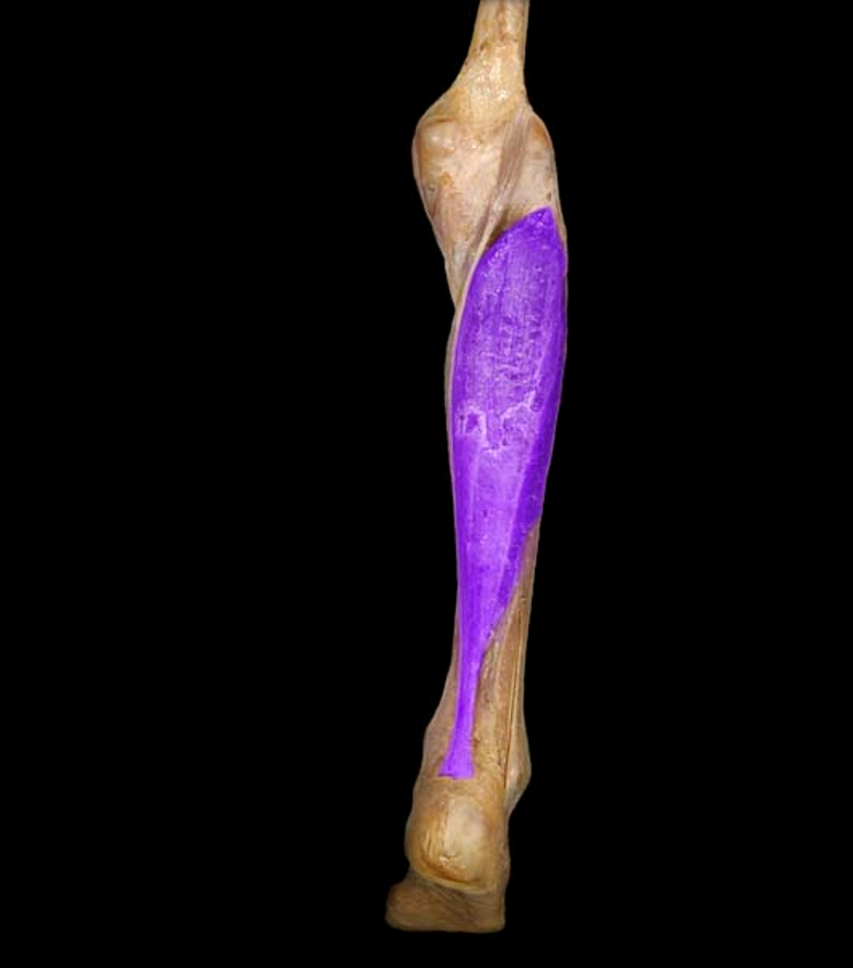 <p>What muscle is this?</p>