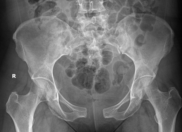 <p>What is the diagnosis?</p>