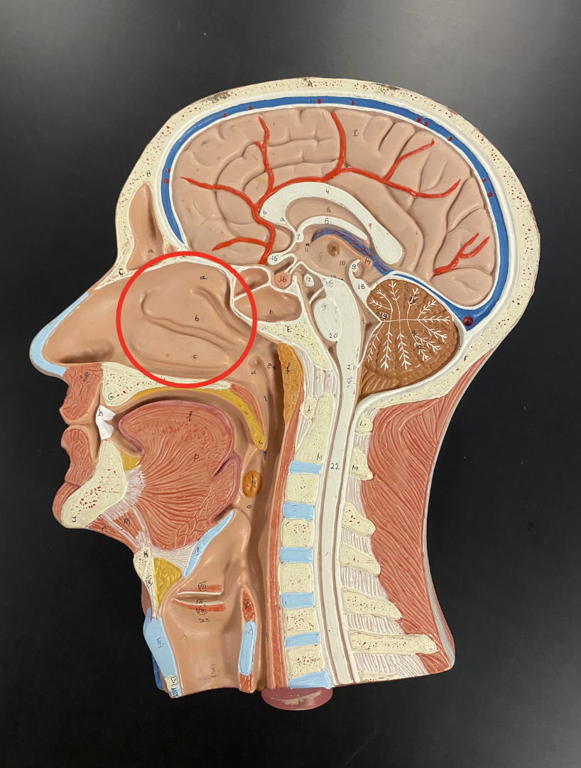 <p>Name the type of epithelium found in the highlighted structure</p>