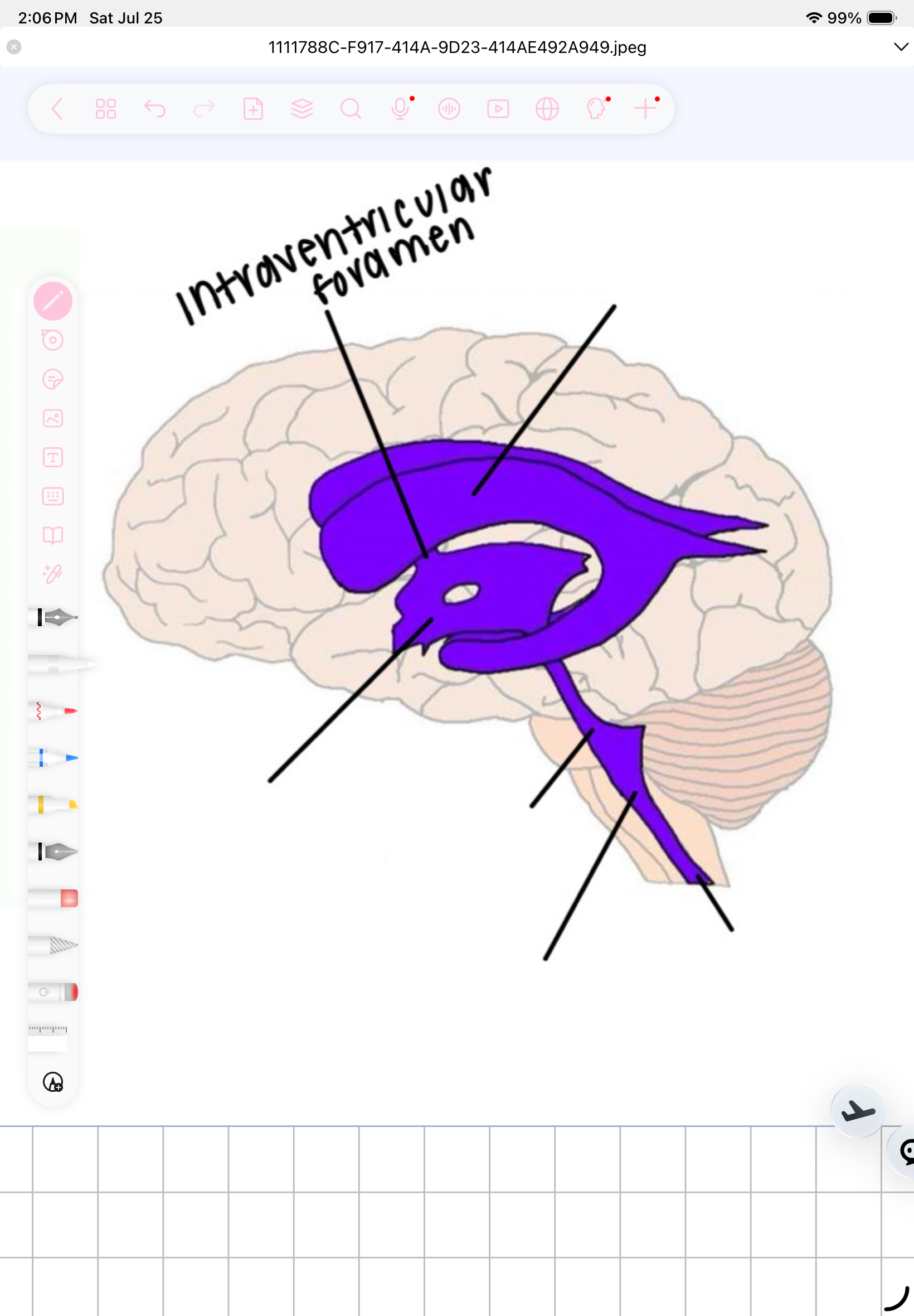 term image