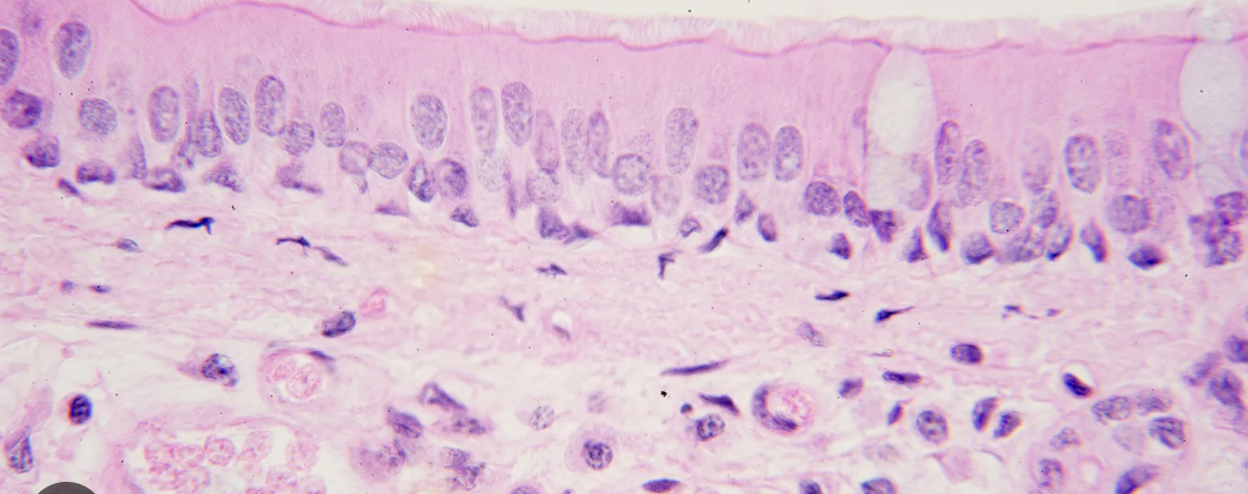 <p>Pseudostratified ciliated columnar epithelium </p>