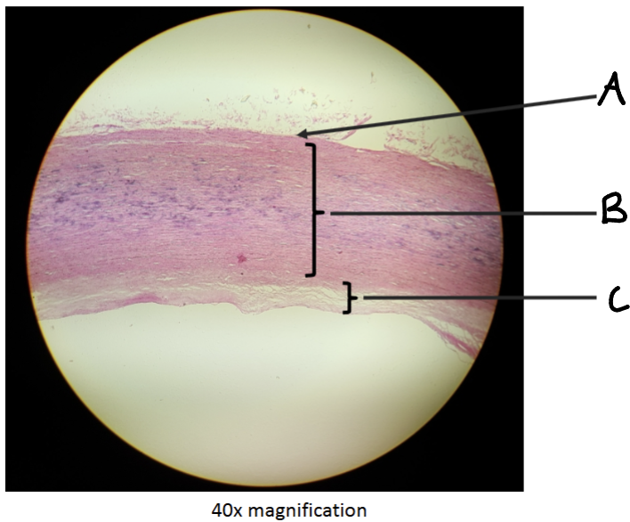 <p>WHat is shown here? What are the layers?</p>