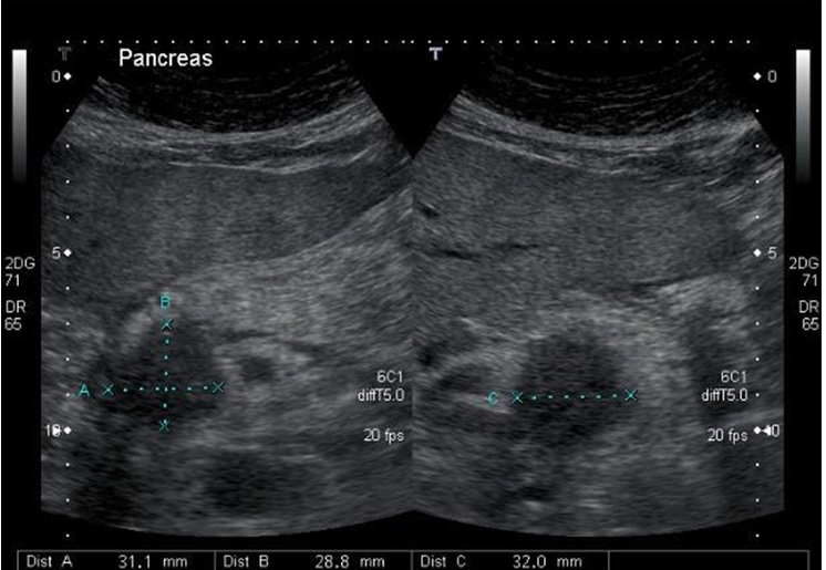 <p>What pathology is this</p>