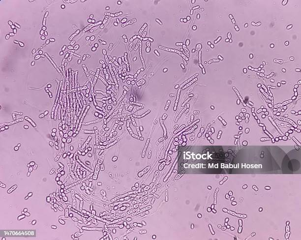 <p>causes tinea versicolor. cells are round on one end and bluntly cut off at the other, where wide budlike structures form singly</p>
