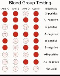 <p>mixing a blood sample with antibodies (anti-A, anti-B, and anti-Rh) to detect antigen clumping.</p><ul><li><p>Yes clumps —> does have that antibody</p></li><li><p>no clumps (solid color) —> doesn’t have that antibody</p></li></ul><p></p>