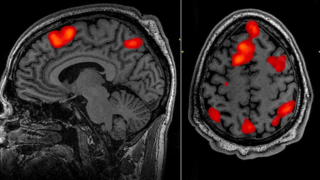 <p>What neuroimaging technique is this? </p>