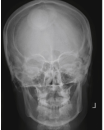 <p>PA Caldwell skull</p>