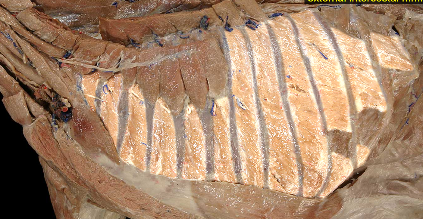 <p>Name the highlighted part and tissue type</p>