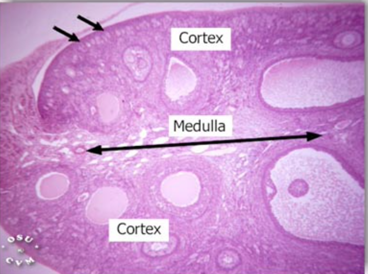 <p>what type of histology is this showing?</p>