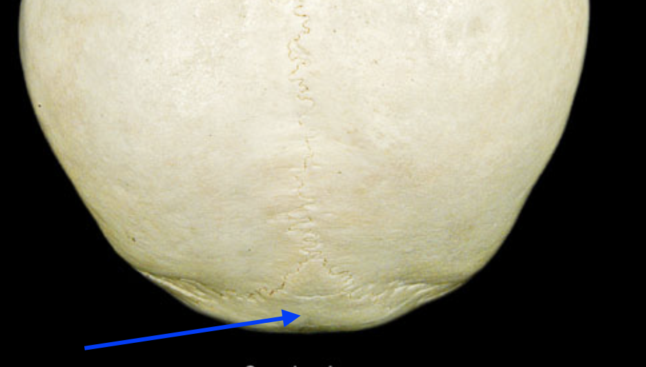 <p>Identify the bony feature of the superior skull.</p>