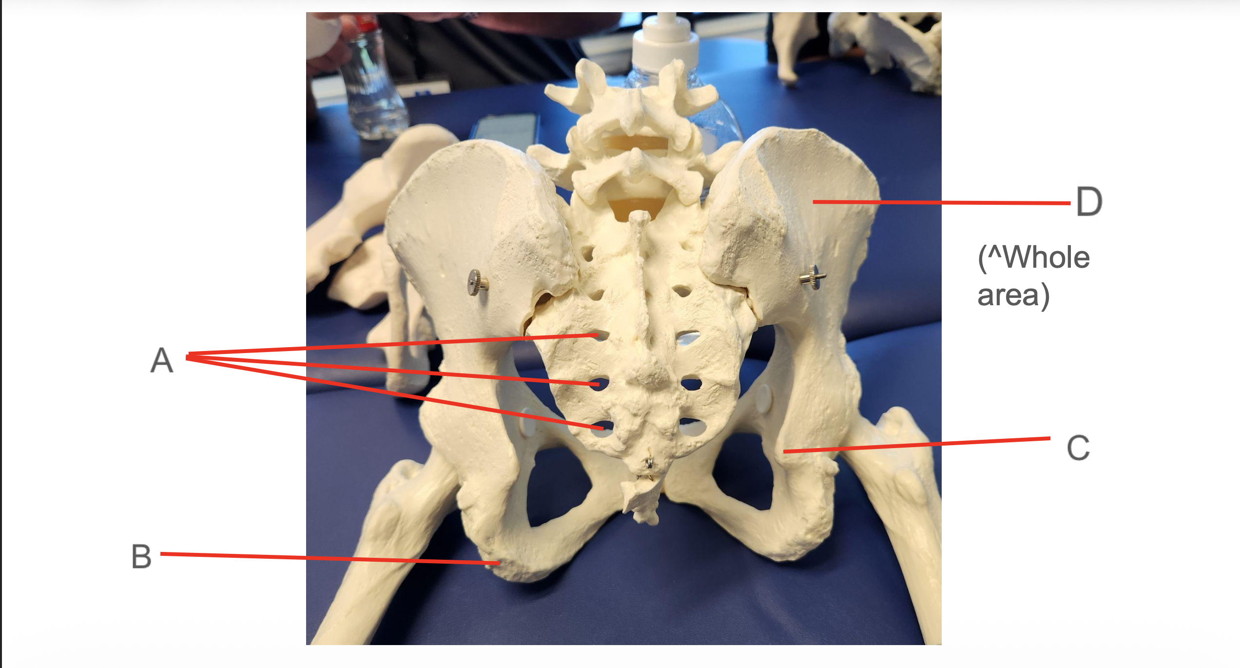 <p>Identify Structure D</p>