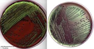 <p>Eosin Methylene Blue emb- differential agent?</p>