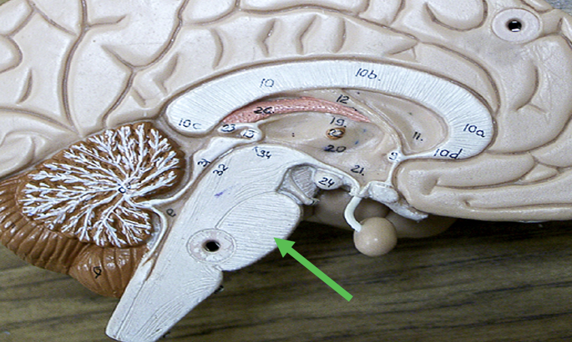 <p><span>Identify the area of the brain indicated by the pointer.</span></p>