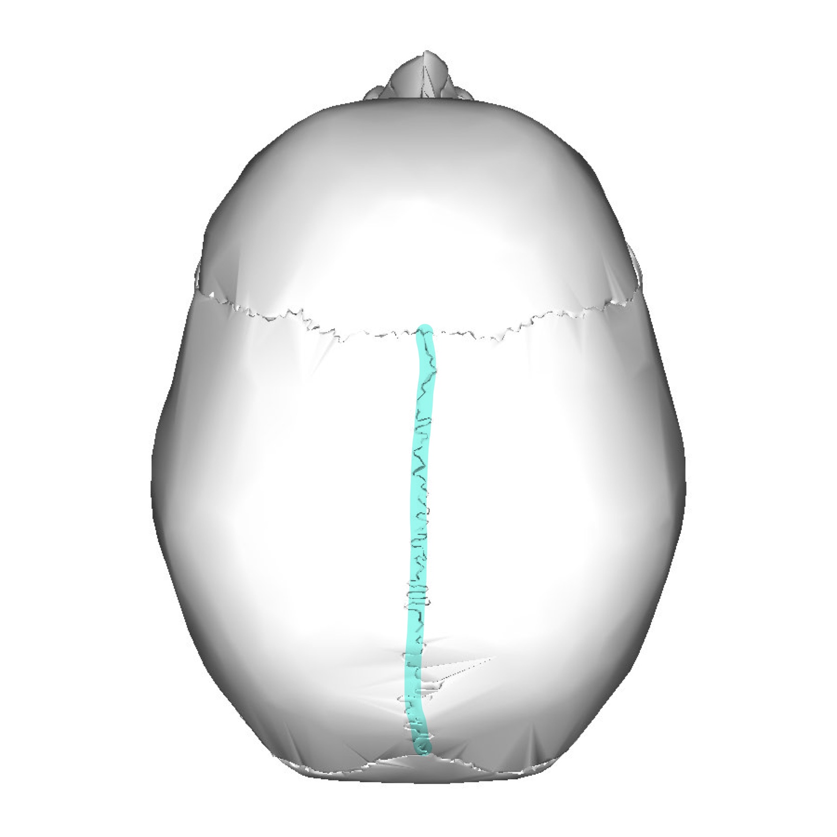 <p>What is the highlighted suture</p>