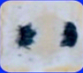 <p>what stage of mitosis is this? what type of cell is this?</p>