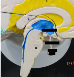 <p>Label the structures in this image from top to bottom.</p>