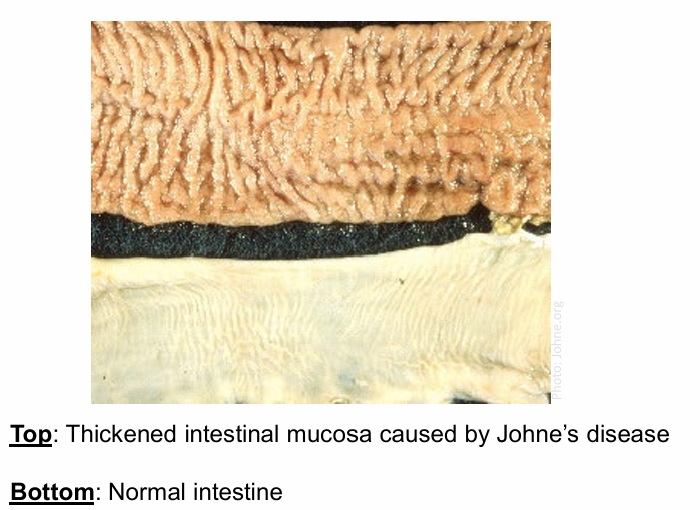 <p>Thickened and corrugated intestine with enlarged and edematous neighboring lymph nodes</p>