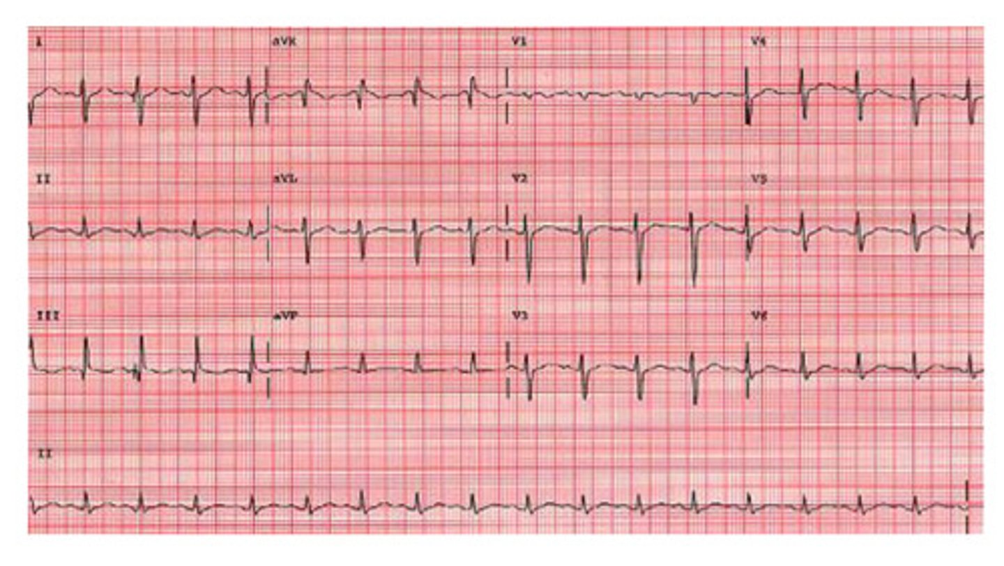 <p>this is an example of ________ pattern in ______ _______</p>