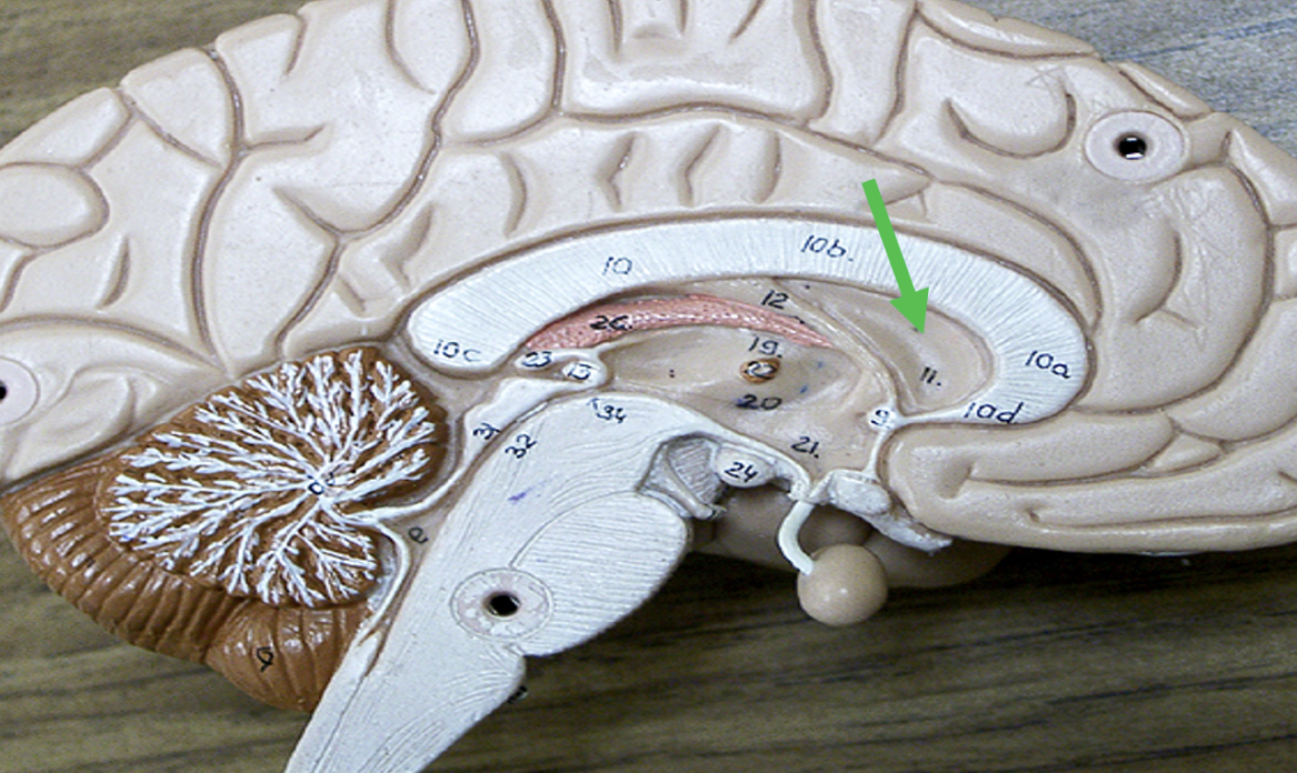 <p>Identify the <strong>space</strong> in the brain indicated by the pointer.</p>
