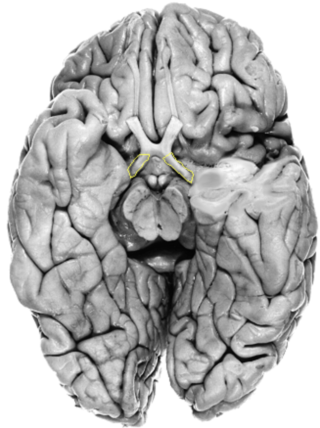 <p>What is the area highlighted called?</p>