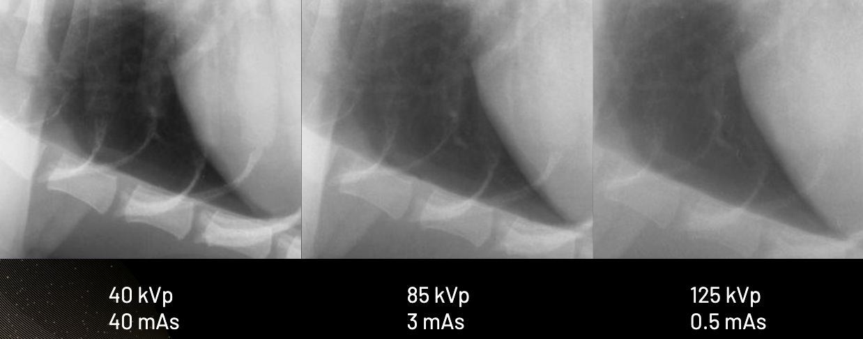 <p>Excessively high contrast can <strong>obscure peripheral pulmonary vessels and small nodules</strong></p>