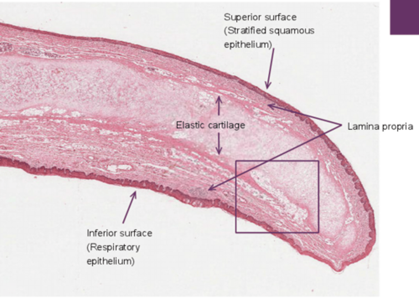 <p>SSNKE buccal epithelium on one side and PSCE on the respiratory side. this is because it is normally in an upright position and resp e is continuous with the airway . epiglottis closes to cover trachea on swallowing and the aspect lined with SSNKE provides protection from abrasion from boluss</p>