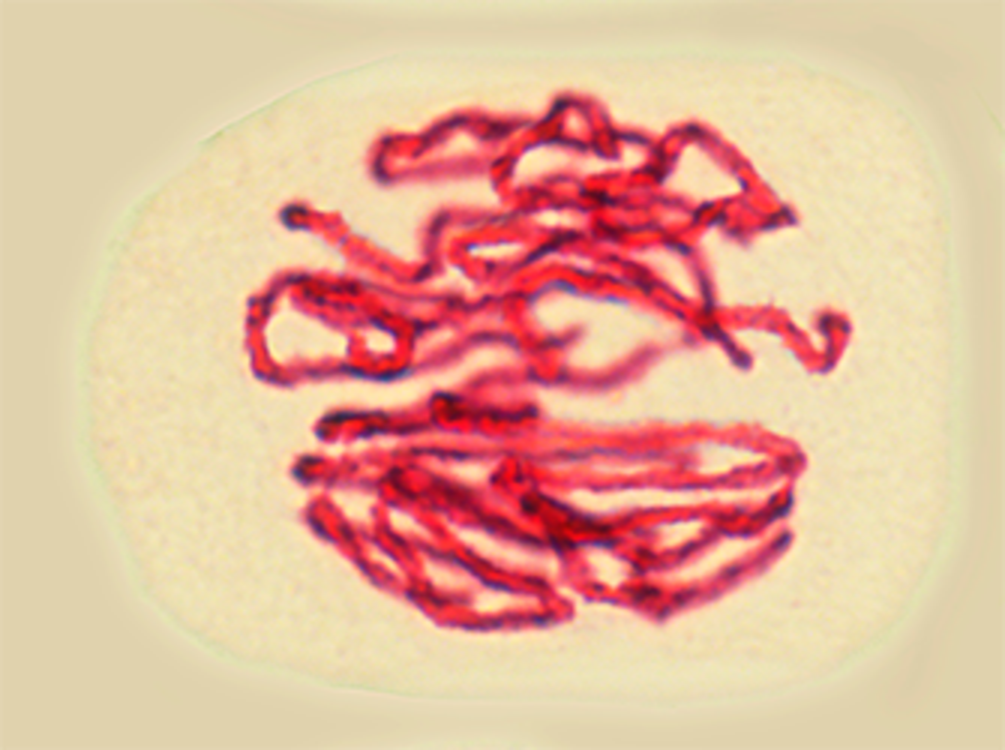 <p>Describe in 2 different ways the arrangement of the genetic material shown in the above image</p>