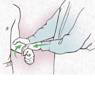 <p>Bend the elbow at your side. Start with your palm facing in. Try to turn your palm up while someone tries to stop you. Pain in the front of the shoulder is positive.</p>