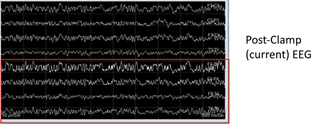 <p>perfusion, symmetric</p>