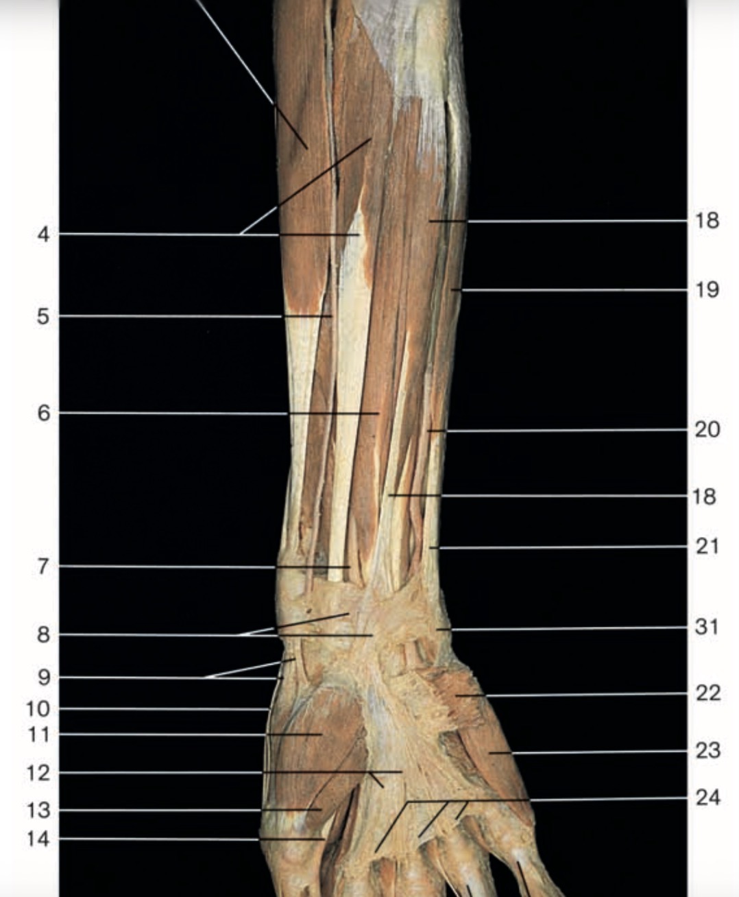 <p>Pinche 5</p>