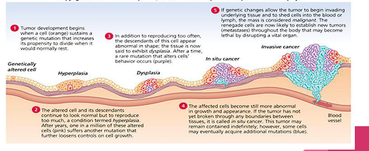 <ul><li><p>Early Changes (Initiation and Early Hyperplasia)</p></li><li><p>Middle Changes (Dysplasia and Benign Tumor Growth/ In situ cancer)</p></li><li><p>Late Changes (Malignancy, Invasion, and Metastasis)</p></li></ul><p></p>