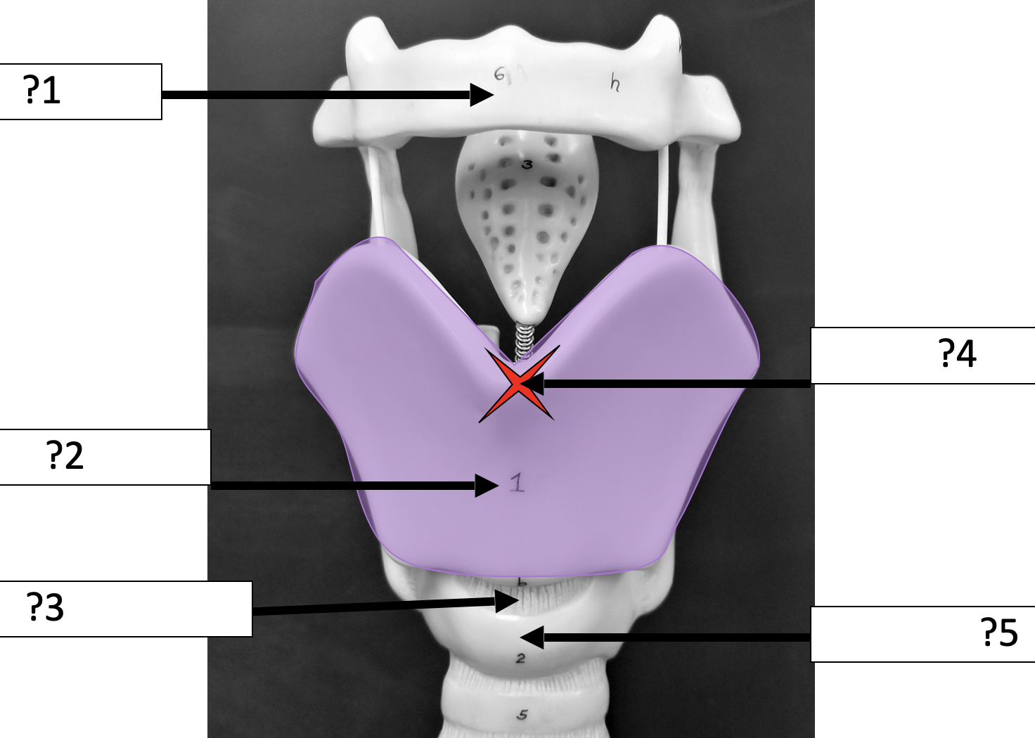 <p>5 Name the structure? </p>