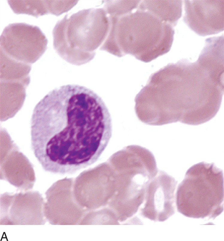 <p>what is a metamyelocyte?</p>