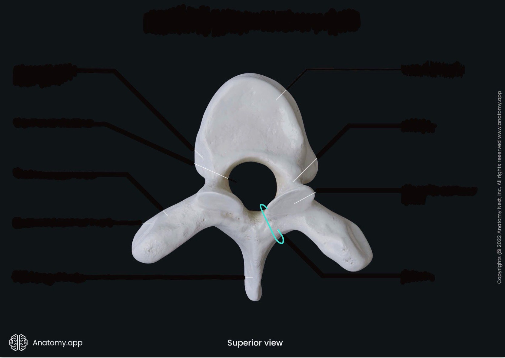 <p>what is the highlighted bony landmark</p>